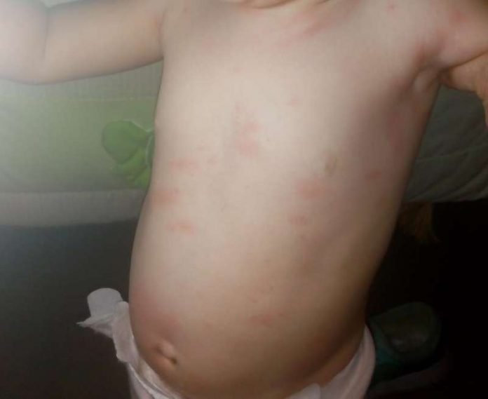 Madre denuncia que su hija sufre “alergia ambiental” debido al polvo que emite una planta de silos