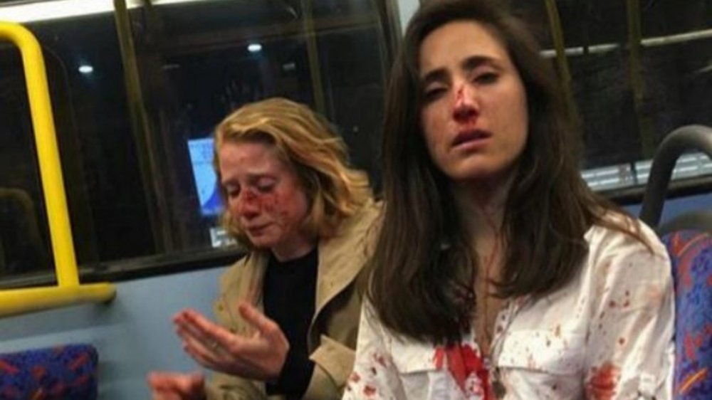 Brutal golpiza contra una pareja de mujeres en Londres: 