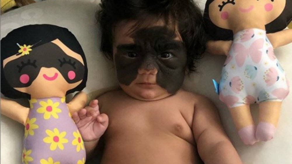 Una bebé se convirtió en estrella de Instagram con su marca de nacimiento