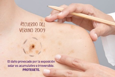 Campaña contra el cáncer de piel en Provincia: Controles gratuitos hasta el 22 de noviembre