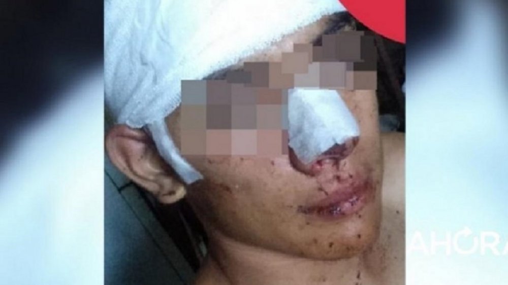 Una patota manoseó a su novia y le dieron una paliza cuando intentó defenderla