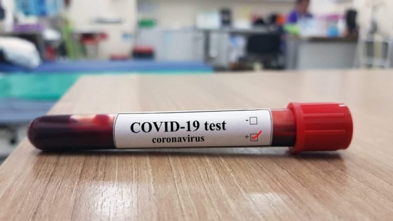 36 juninenses fueron diagnosticados con COVID 19