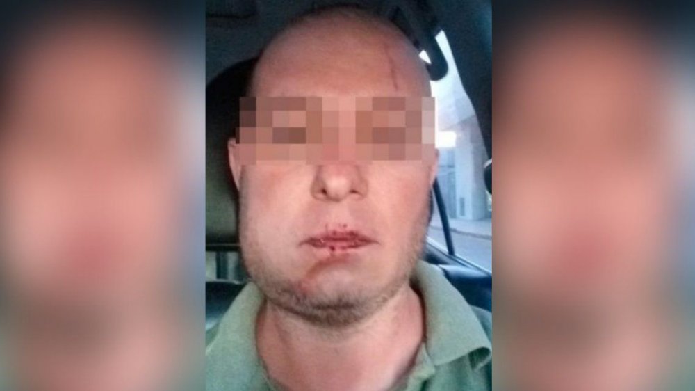 Córdoba: cuatro policías detuvieron a un hombre por error y le quebraron la mandíbula