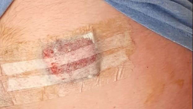 Hieren con un arma blanca a un comerciante en intento de robo