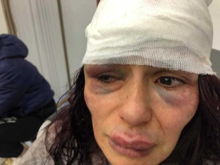 Una mujer fue brutalmente golpeada por delincuentes