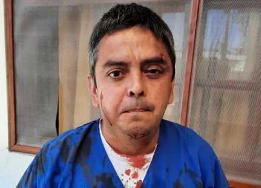 Se contagió covid y agarró a piñas al Secretario de Salud