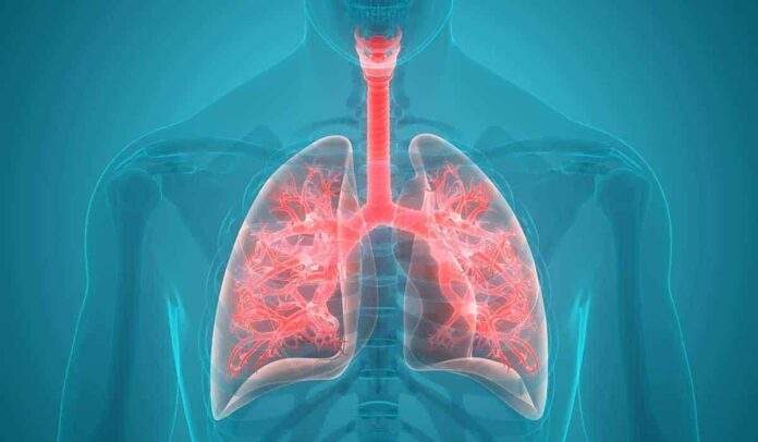 Hipertensión pulmonar: qué es, cómo se llega al diagnóstico y cuál es el tratamiento